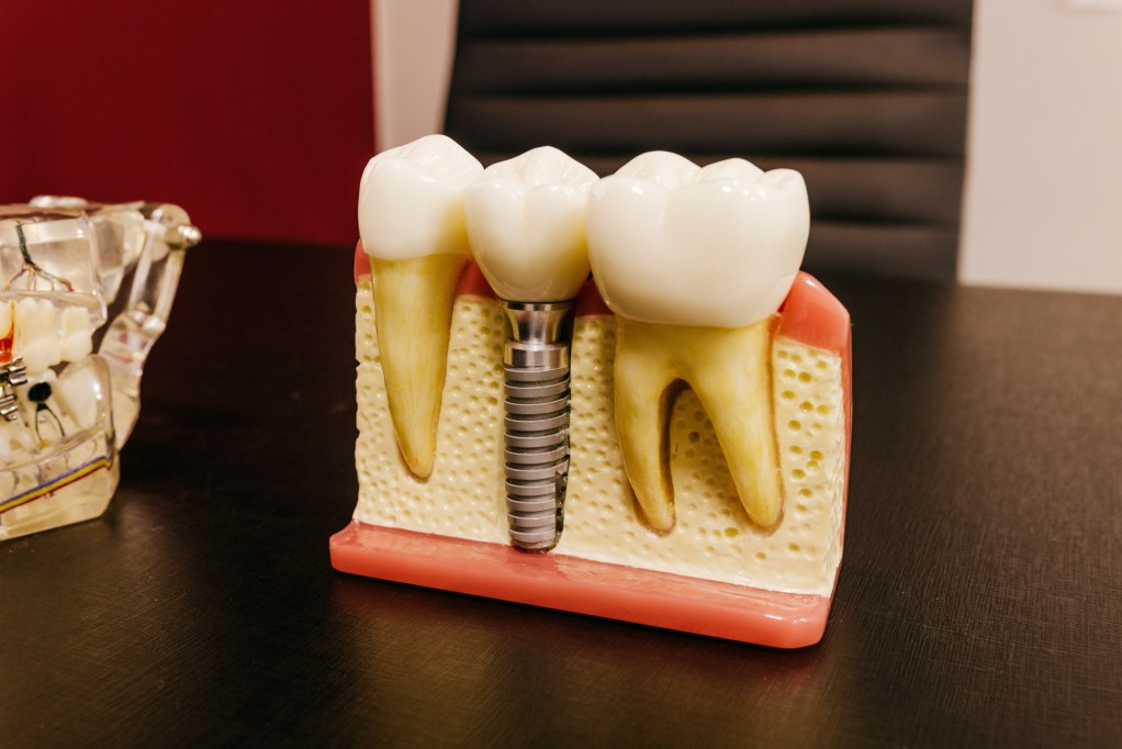 Demonstration of a dental crown for implant on a desk