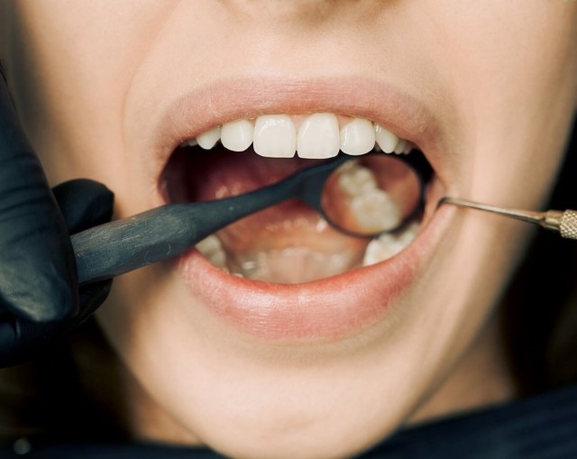 Best dental implant dentist in Los Algodones; smile during dental implant check