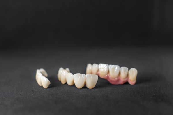 Algodones dental crowns; dental crowns in black background